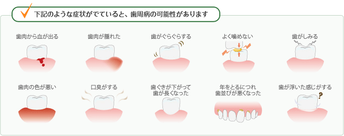 このような症状がみられる方は歯周病の可能性があります。